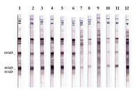 Test sérologique Western Blot